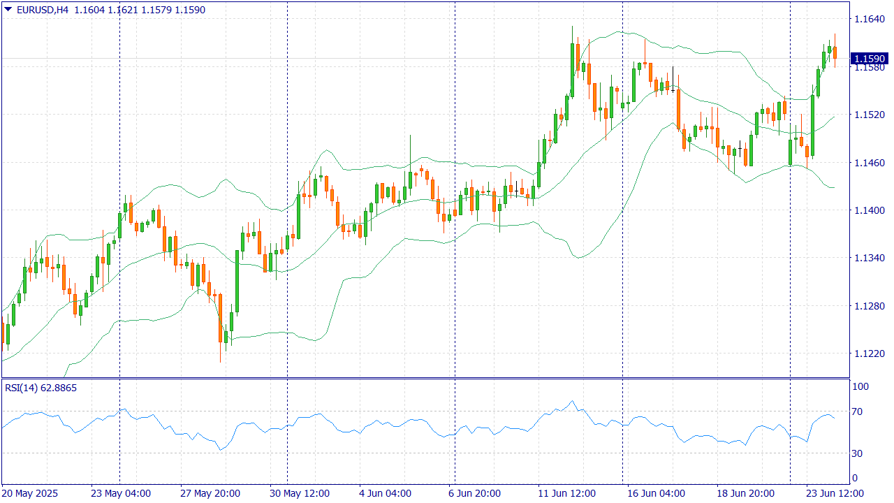 EURUSD: BUY 1.1625, SL 1.1545, TP 1.1725